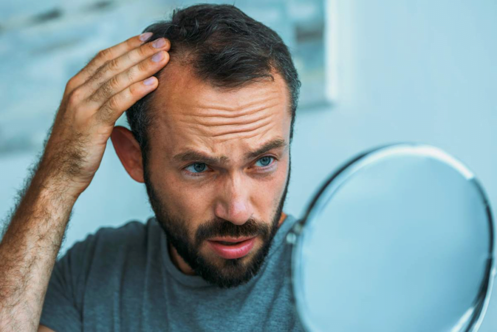 Cost of Hair Transplant: A Comprehensive Guide