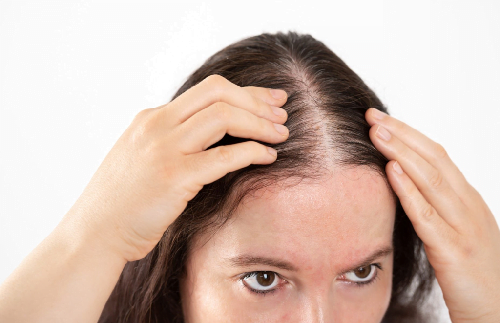 Hair Transplant for Women in Turkey: A Comprehensive Guide