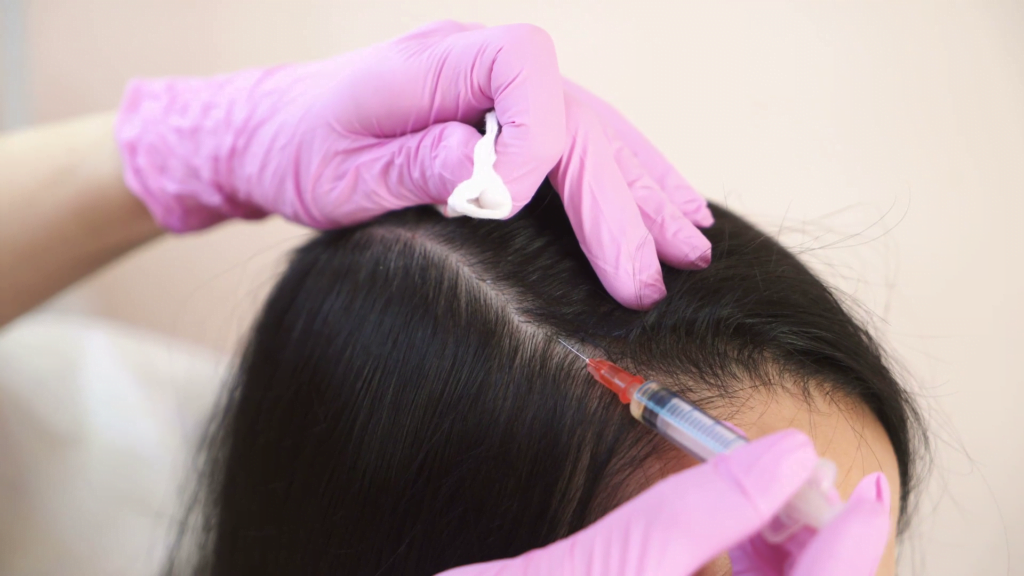 Análisis de los costos de la cirugía de reemplazo de cabello en los EE. UU.: comparación ciudad por ciudad