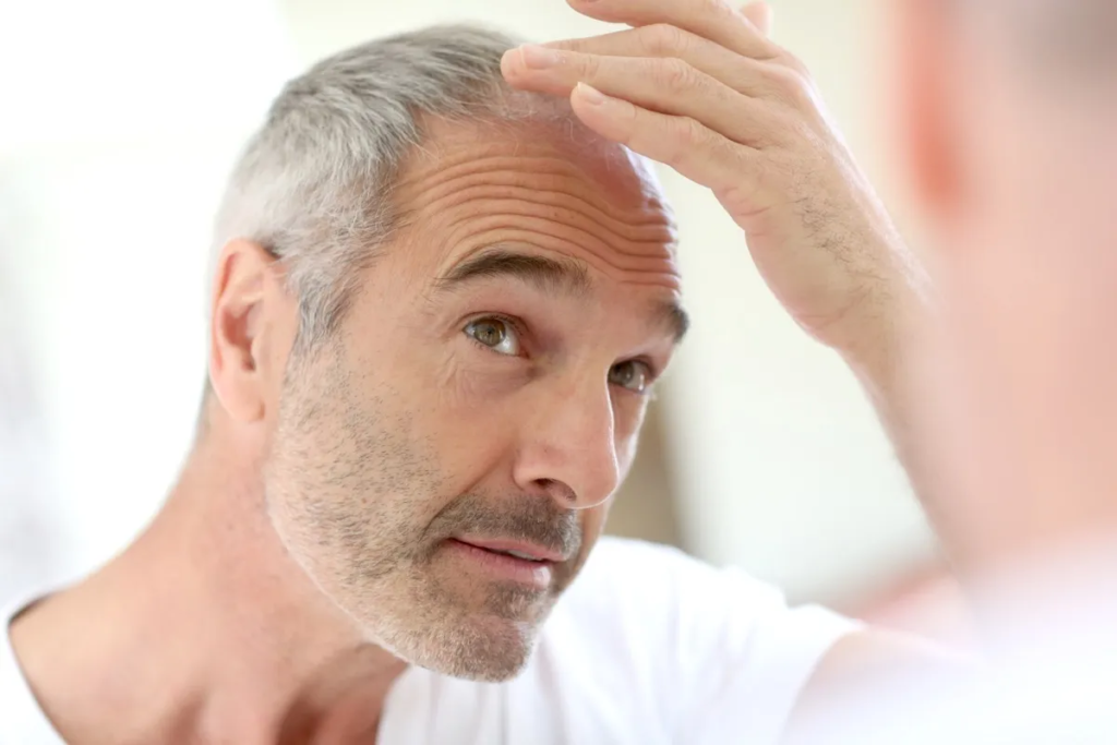 Hair Replacement Surgery in Turkey: Cost Breakdown and Considerations