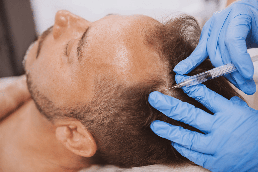20 Fragen an Ihren Haartransplantationsarzt: So können Sie sich für eine erfülltere Zukunft entscheiden