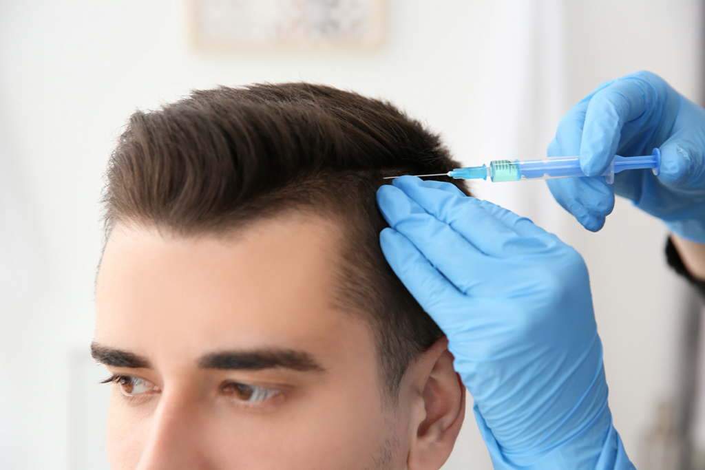 20 Questions to Ask Your Hair Transplant Doctor: Empowering Your Decision for a Fuller Future